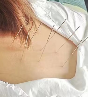 女子針灸_副本.png
