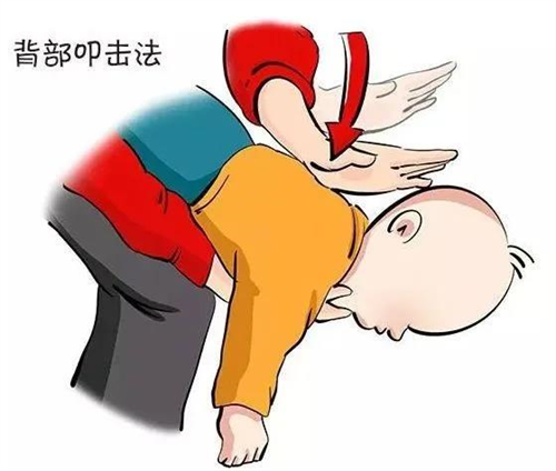 異物卡喉的急救.png