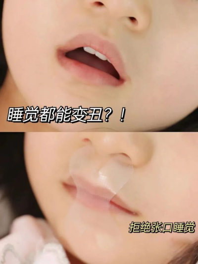 張口貼真的有用嗎_副本.png
