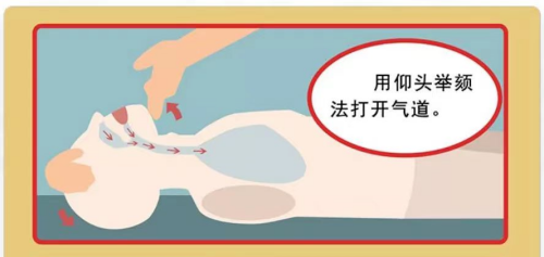 開放氣道手法_副本.png